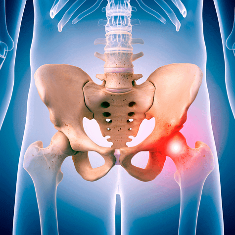 Sudden Sharp Hip Pain Common Causes And Proven Treatments Facts Physio