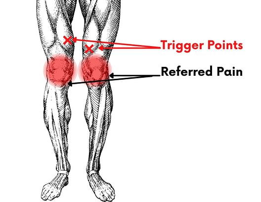 how-to-recover-from-quadriceps-injury-pain-above-the-knee-facts