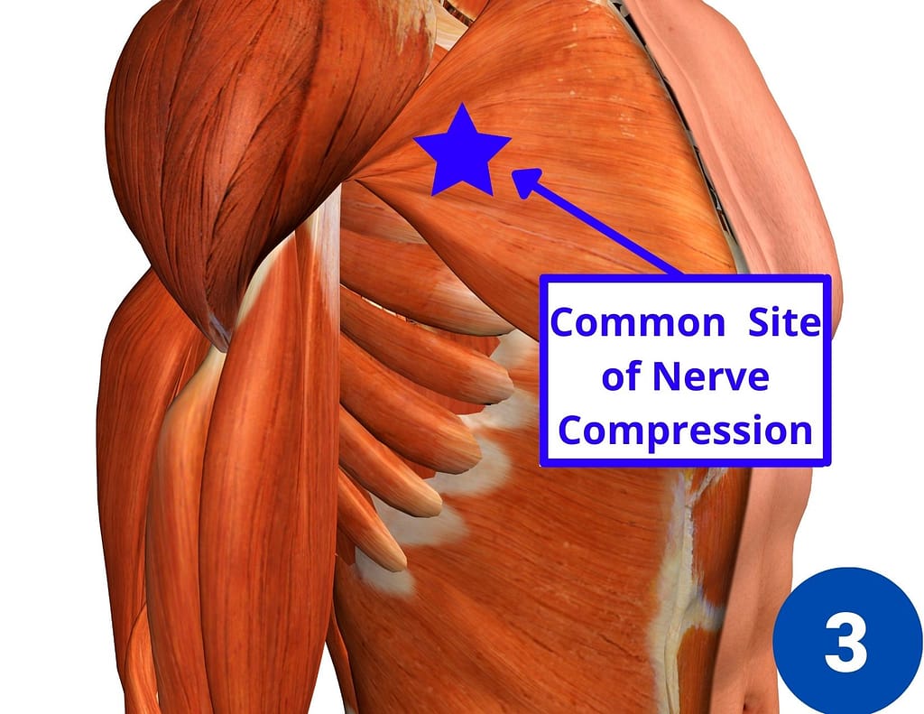 7 Causes Of Shoulder Pain And Tingling In The Fingers Facts And Physio